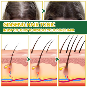🌿 OUHOE Natural Herbs® – Revitaliza tu cabello, barba y cejas de forma natural ✨