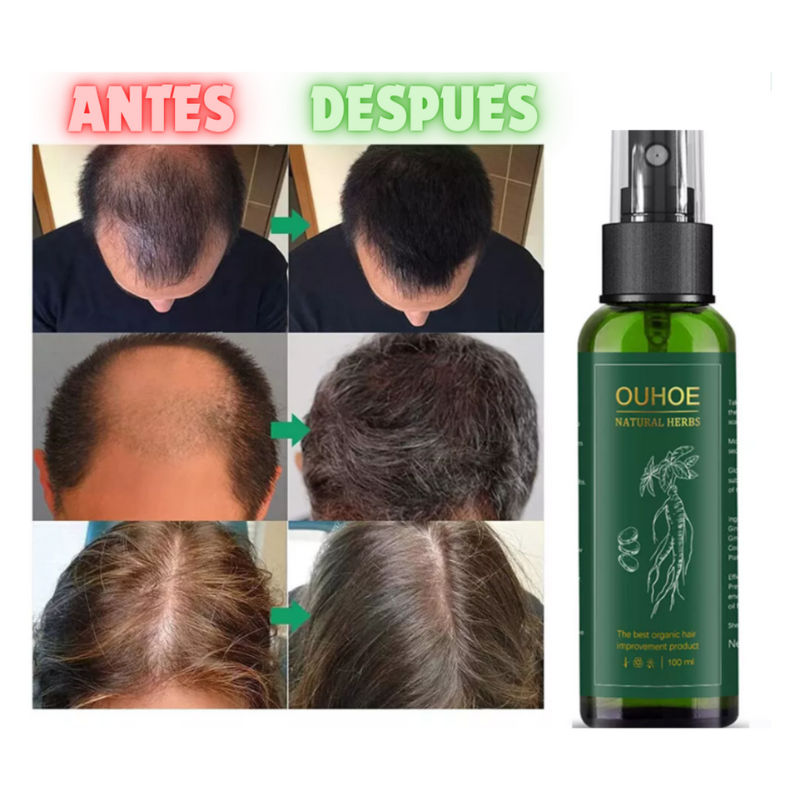 🌿 OUHOE Natural Herbs® – Revitaliza tu cabello, barba y cejas de forma natural ✨